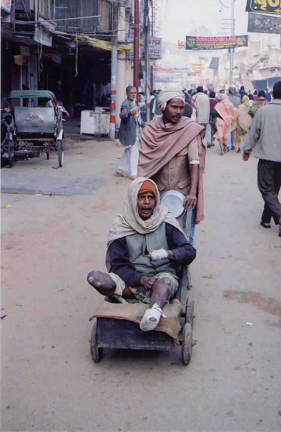 Man With Leprosy / India - Click Image to Close